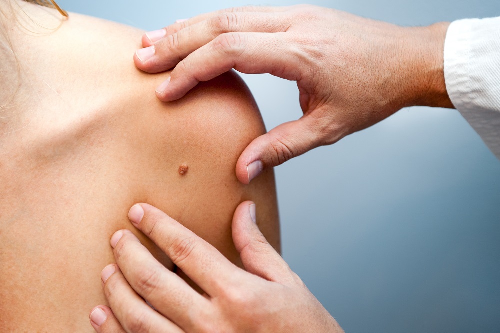 Ambulatorio Dermatologia Roma CLinica Sanatrix