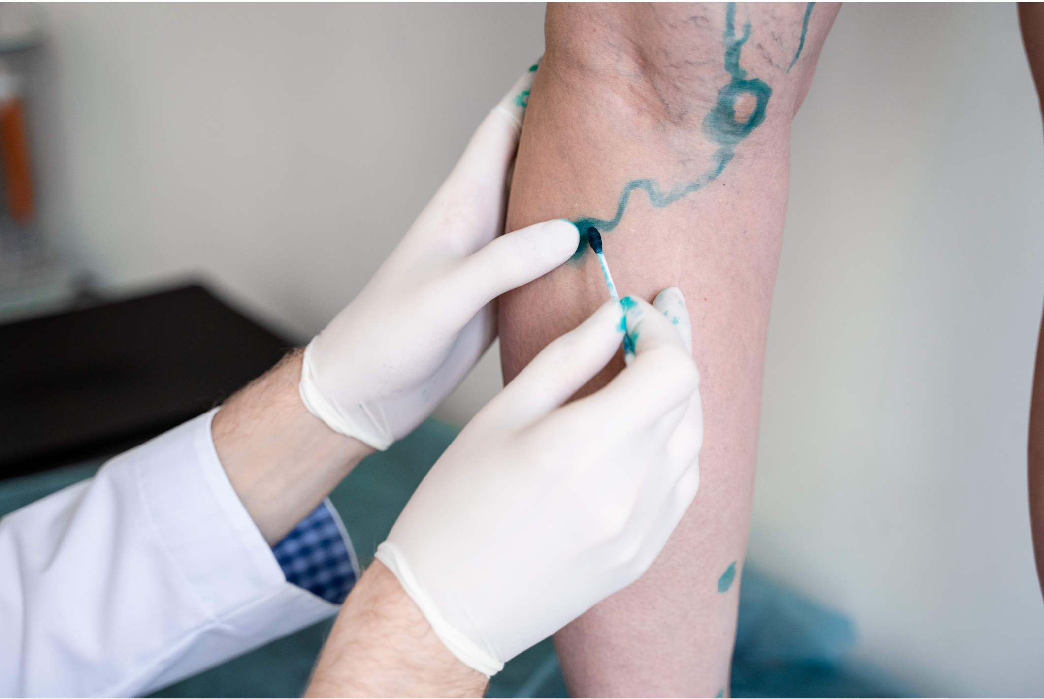 La Chirurgia Vascolare alla Clinica Sanatrix: Un'Eccellenza a Roma